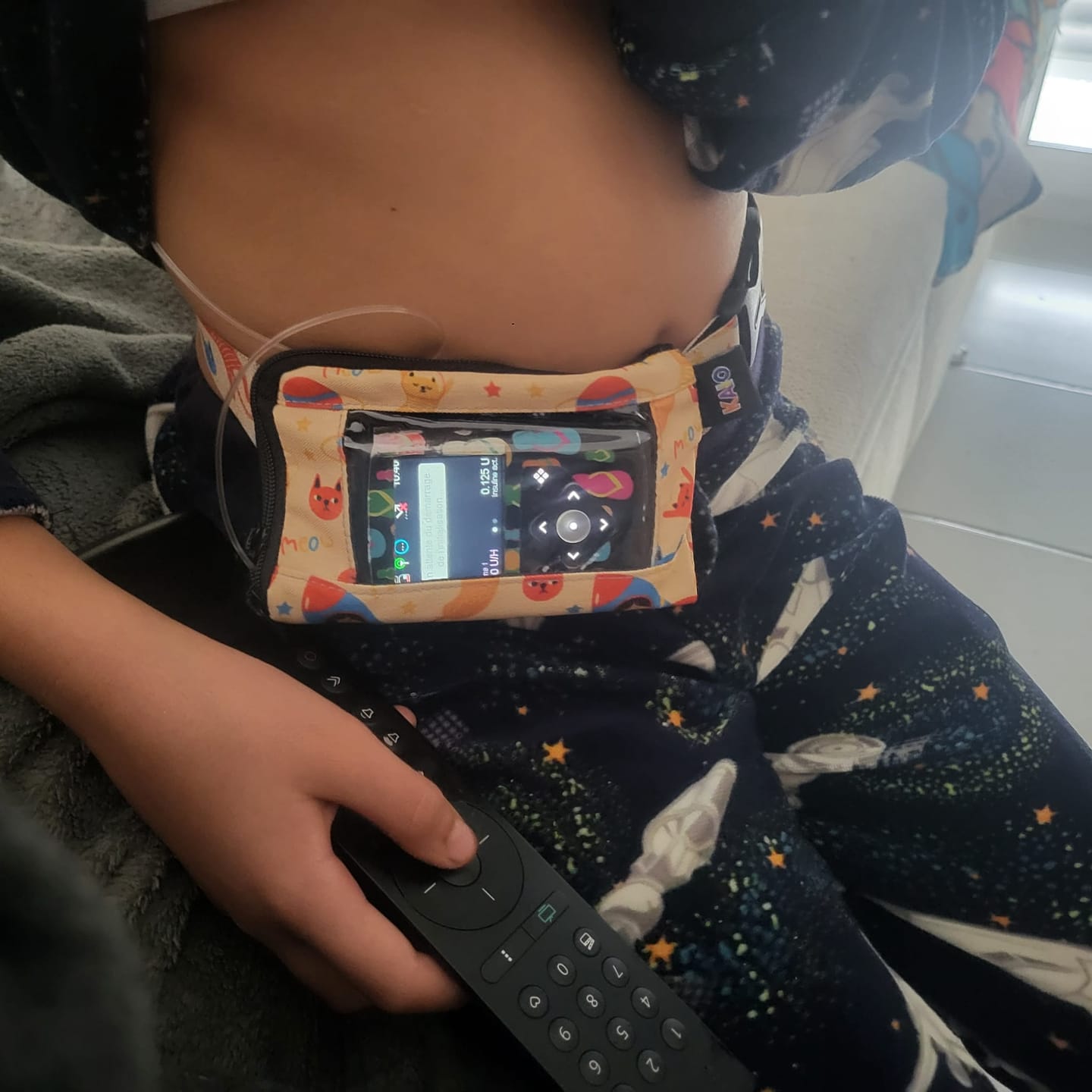 Customer photo review of Insulin Pump Belt for Kids, Dia-Children's Pump Belt W