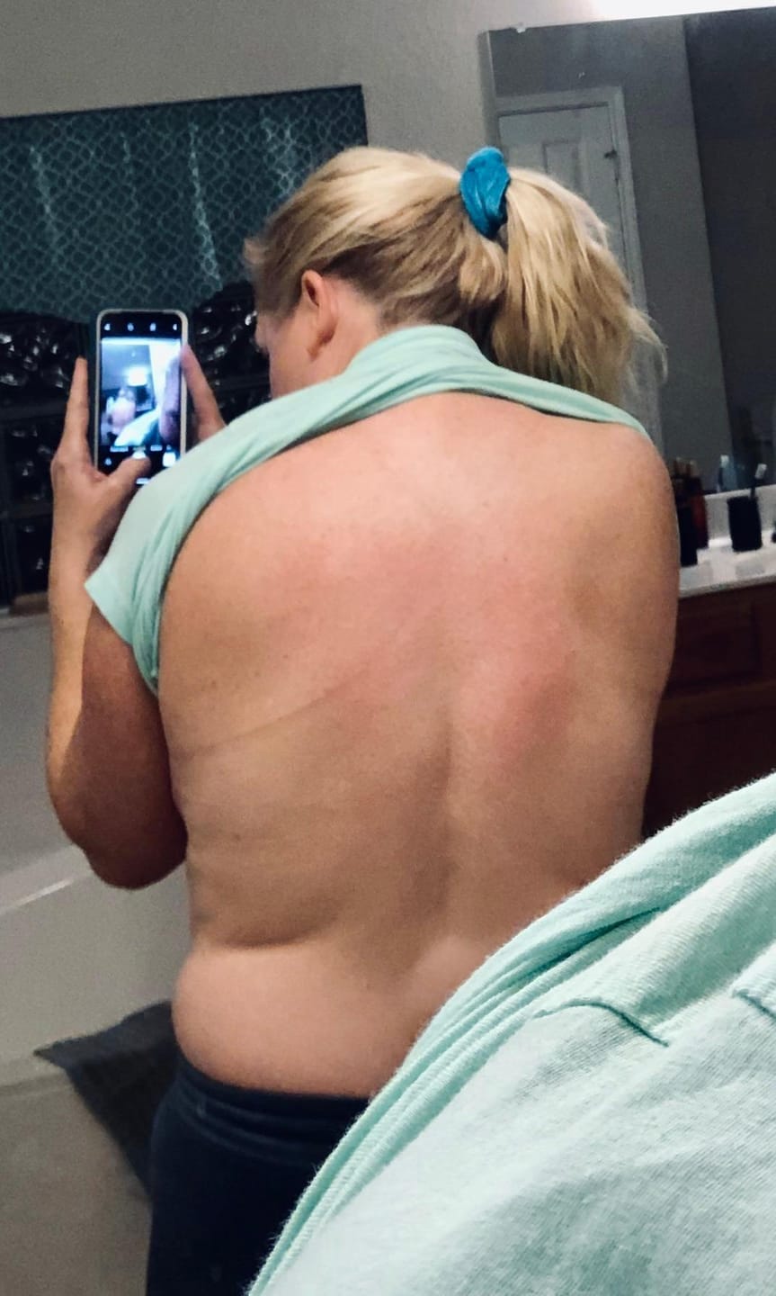 Customer photo review of CalmCraft™️  | Acupressure Mat