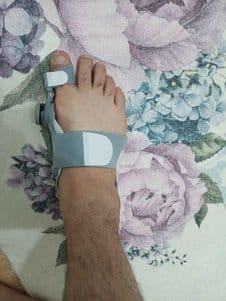 Customer photo review of Podiara™ Orteză Reglabilă Pentru Monturi