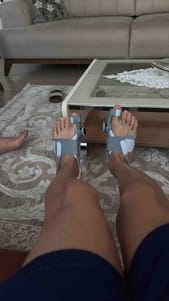 Customer photo review of Podiara™ Orteză Reglabilă Pentru Monturi