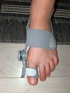 Customer photo review of Podiara™ Orteză Reglabilă Pentru Monturi