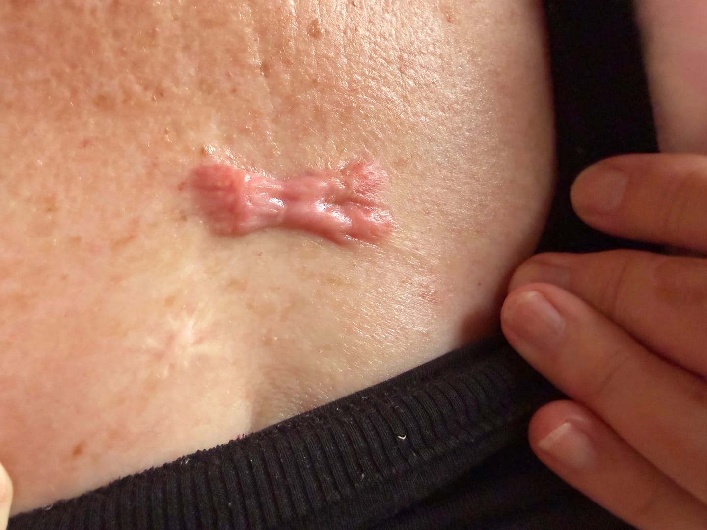 Customer photo review of DermaGen Manuka Oil Balm