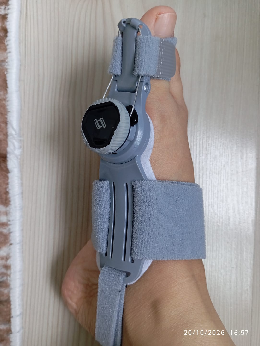 Customer photo review of Foot Medikal™ Ayak Ateli