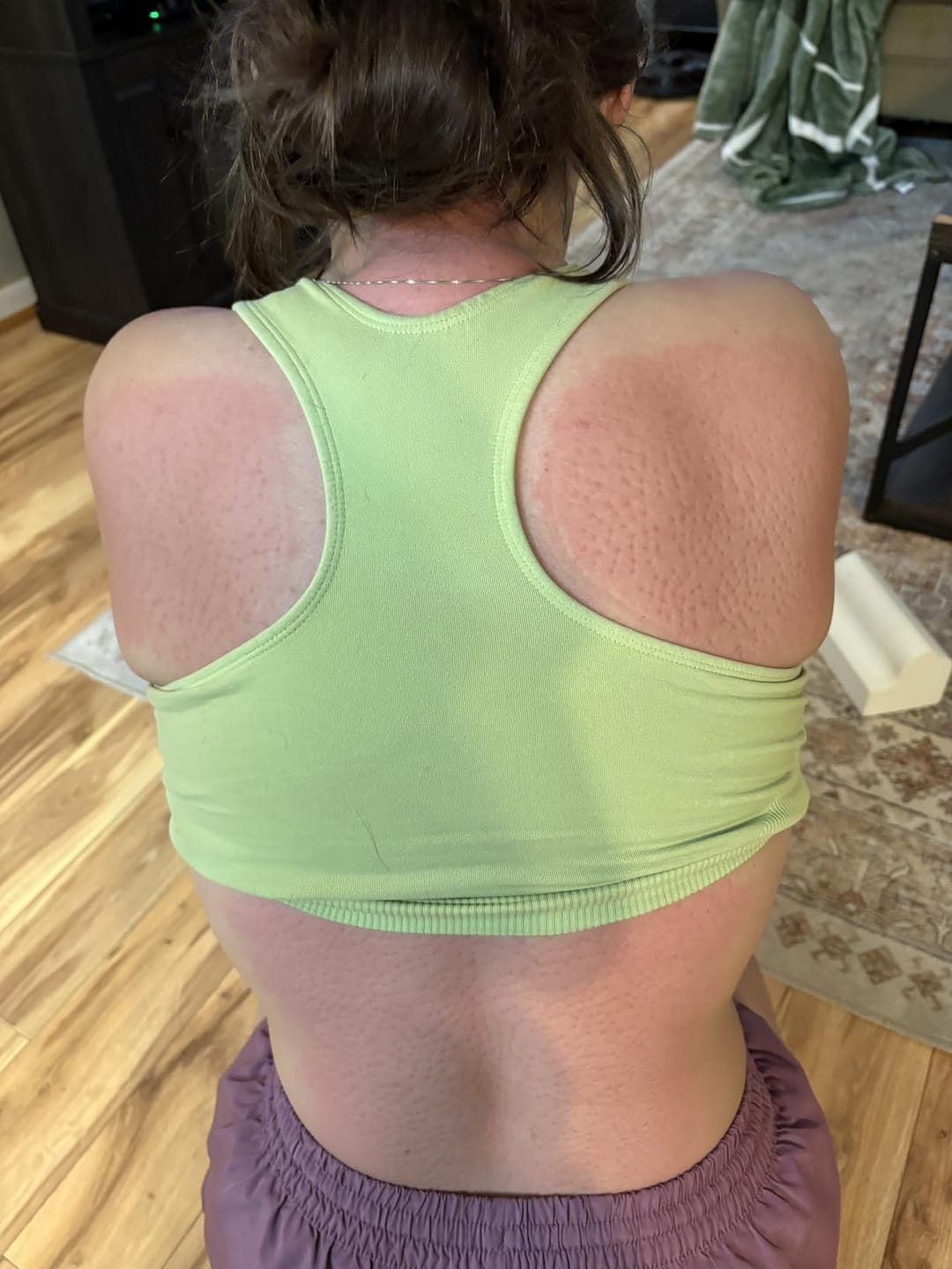 Customer photo review of CalmCraft™️  | Acupressure Mat