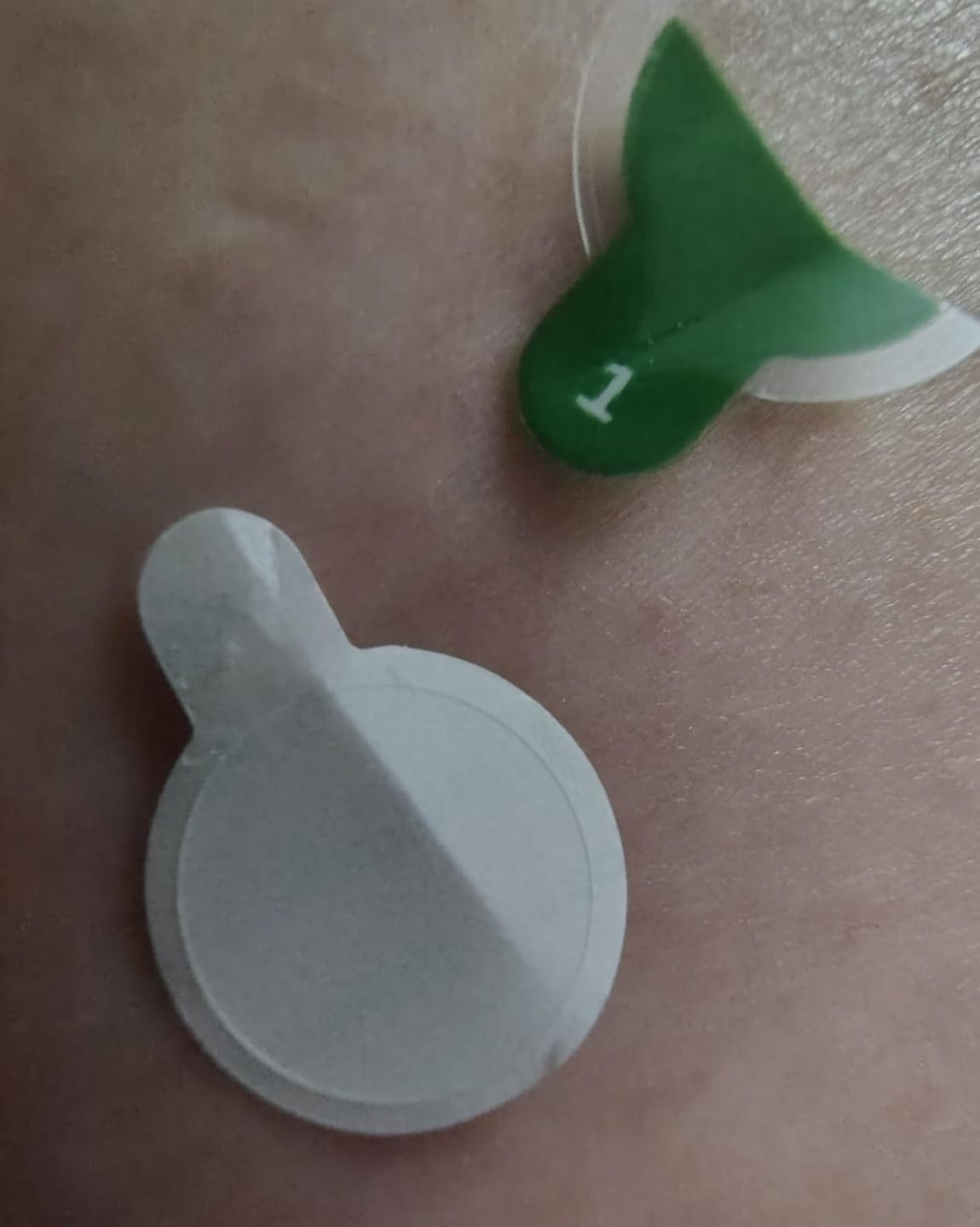 Customer photo review of ZERO-FIT Invisible Vitamin C Spot Patches