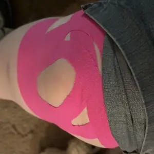 Customer photo review of Supporto Istante Tape Kinesiologico Impermeabile e Traspirante