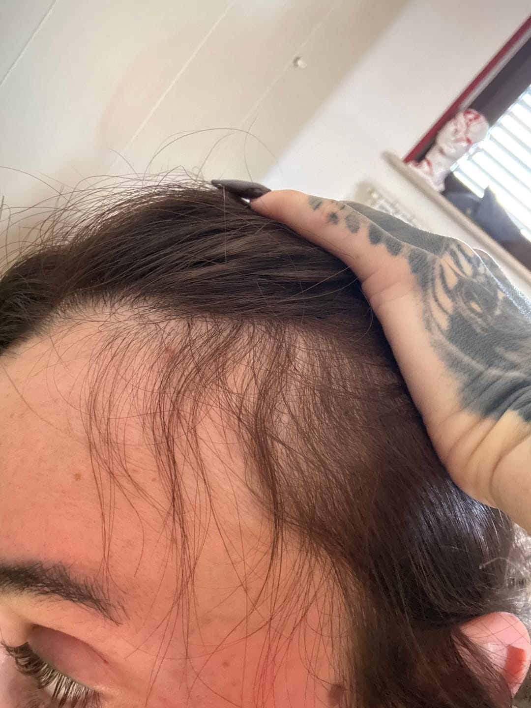 Customer photo review of Rosemary Elixir™ – Scalp & Strand Oil