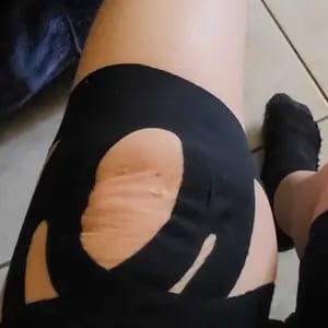 Customer photo review of Supporto Istante Tape Kinesiologico Impermeabile e Traspirante