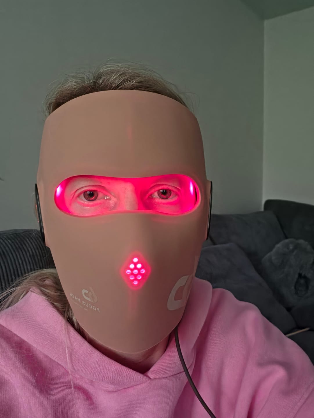 Customer photo review of JOVS 6D Laser & EMS Anti-Aging Therapy Mask