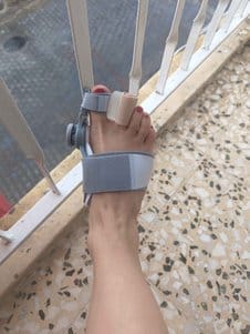 Customer photo review of Podiara™ Orteză Reglabilă Pentru Monturi