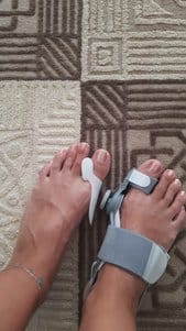 Customer photo review of Podiara™ Orteză Reglabilă Pentru Monturi