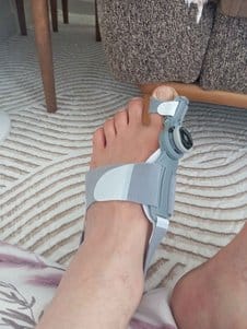 Customer photo review of Podiara™ Orteză Reglabilă Pentru Monturi