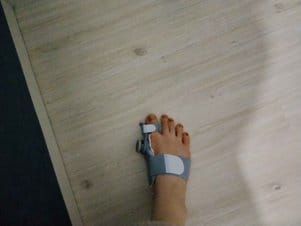 Customer photo review of Podiara™ Orteză Reglabilă Pentru Monturi