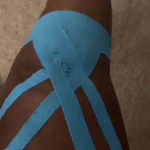 Customer photo review of Supporto Istante Tape Kinesiologico Impermeabile e Traspirante