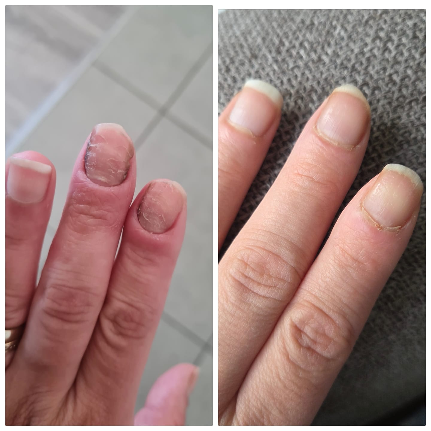 Customer photo review of COLLAGEN MAXX