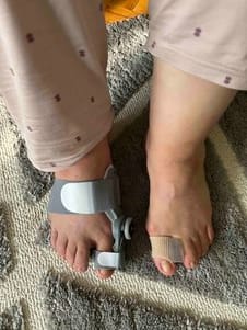 Customer photo review of Podiara™ Orteză Reglabilă Pentru Monturi