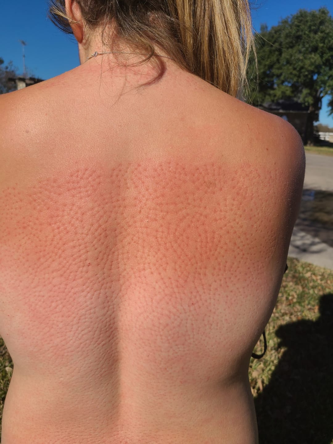 Customer photo review of CalmCraft™️  | Acupressure Mat