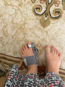 Customer photo review of Podiara™ Orteză Reglabilă Pentru Monturi