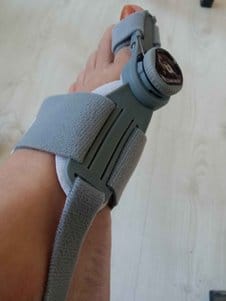 Customer photo review of Podiara™ Orteză Reglabilă Pentru Monturi