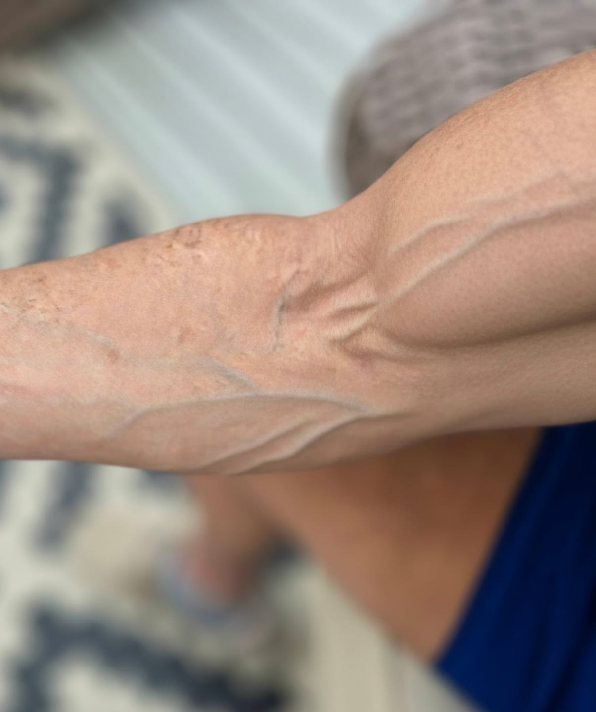 Customer photo review of Urolithin-A Liposomal 1,000mg