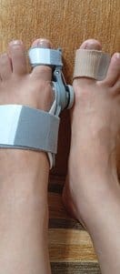 Customer photo review of Podiara™ Orteză Reglabilă Pentru Monturi