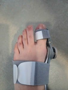Customer photo review of Podiara™ Orteză Reglabilă Pentru Monturi