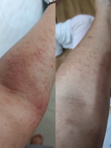Customer photo review of Nourri Skin Daily