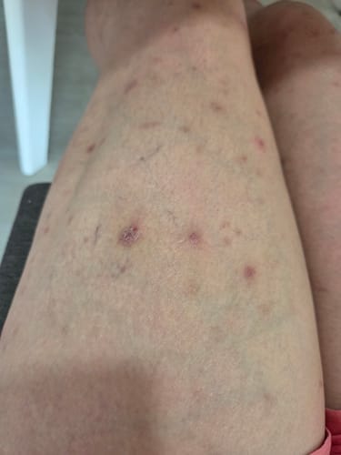 Customer photo review of Nourri Vegan Collagen 363