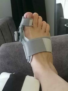 Customer photo review of Podiara™ Orteză Reglabilă Pentru Monturi