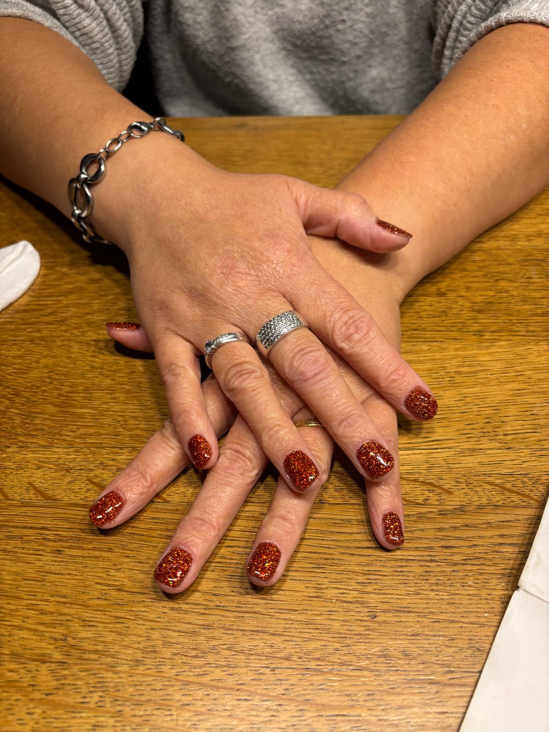 Customer photo review of Verzending Verzekering