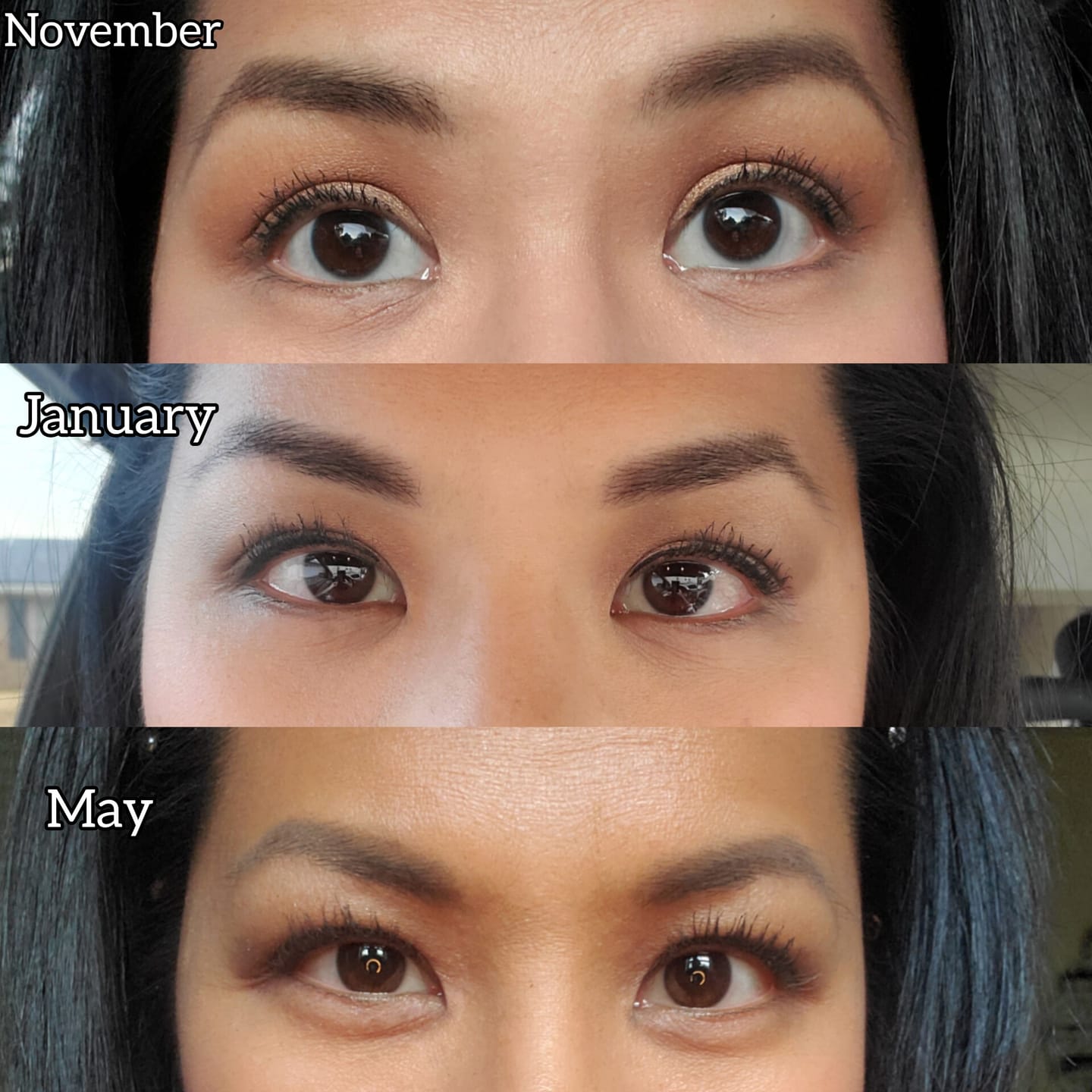 Customer photo review of EYELASH GROWTH SOLUTION
