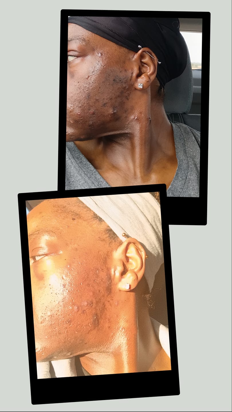 Customer photo review of Turmeric Fade & Glow Bar.