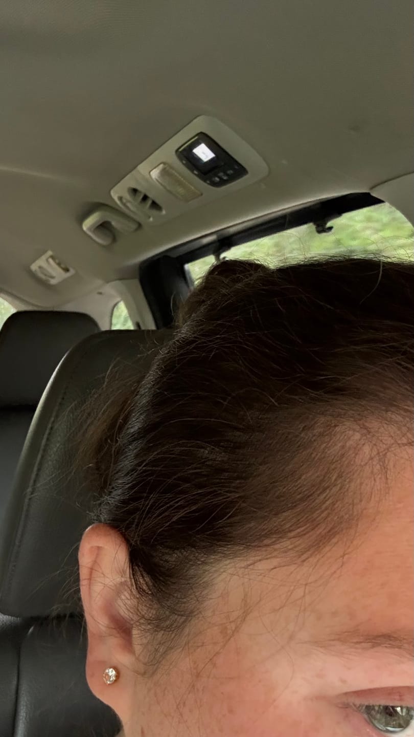 Customer photo review of Hair Growth Serum