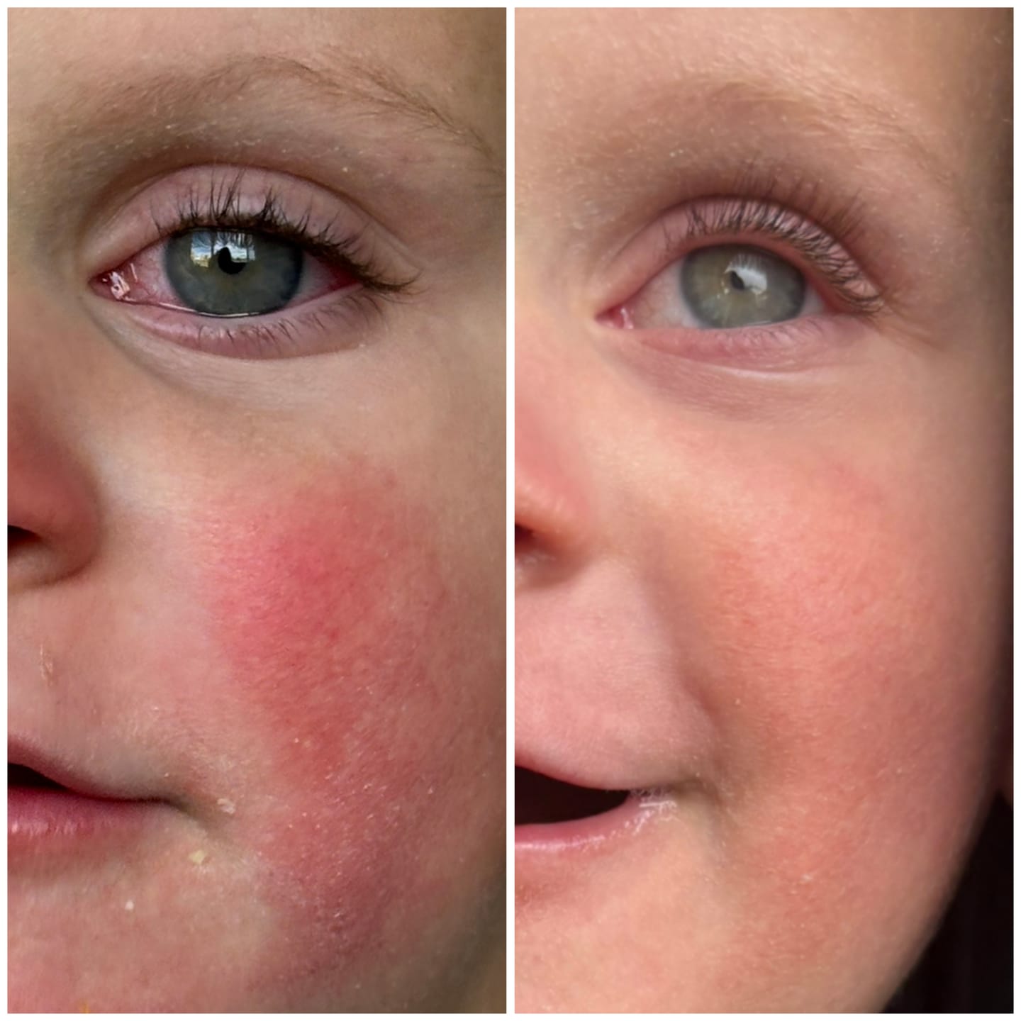 Customer photo review of Cleanse Everyday Immune Boost