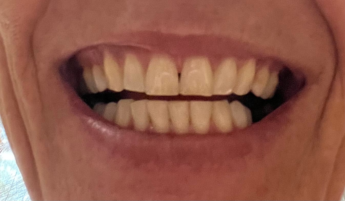 Customer photo review of Teeth Whitening Powder