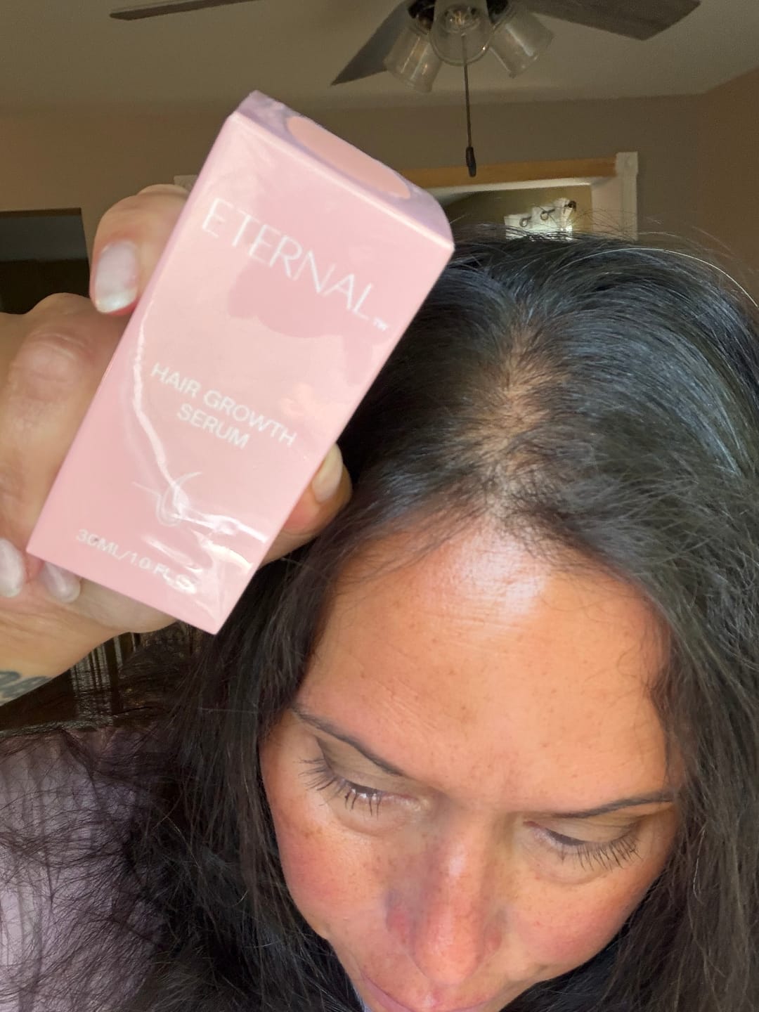 Customer photo review of Hair Growth Serum