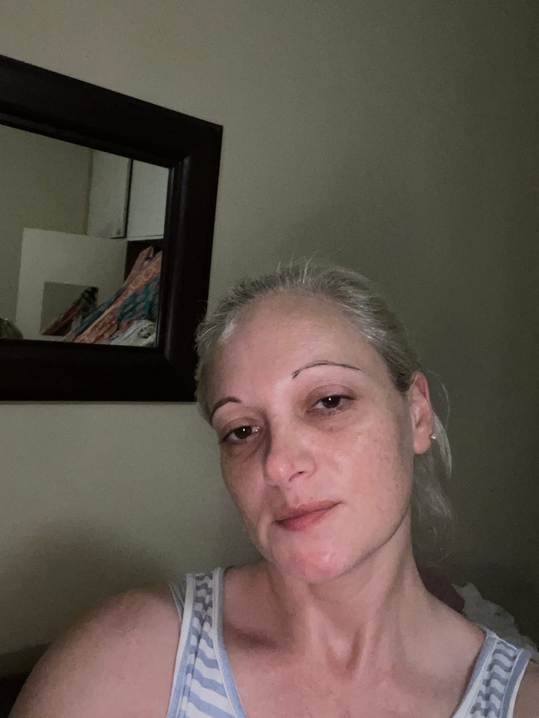 Customer photo review of The Glo Bright Serum