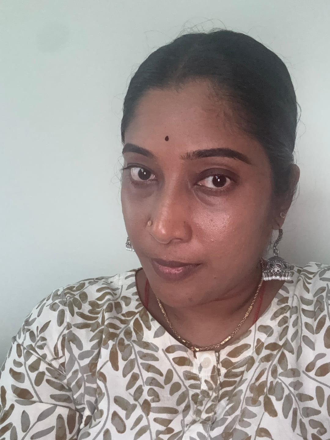 Customer photo review of Ujvala Skin Brightening Moisturizer