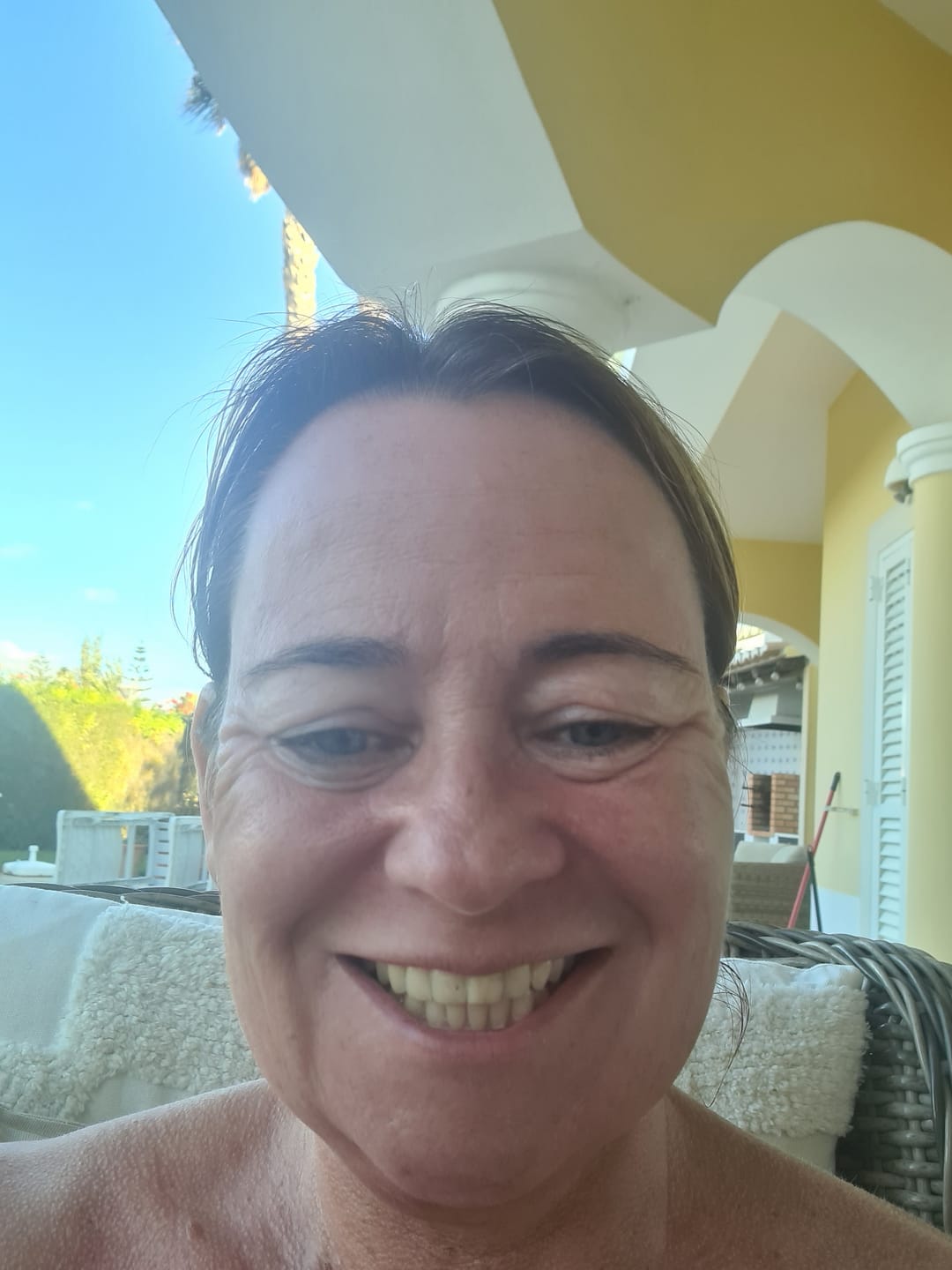 Customer photo review of Teeth Whitening Pen