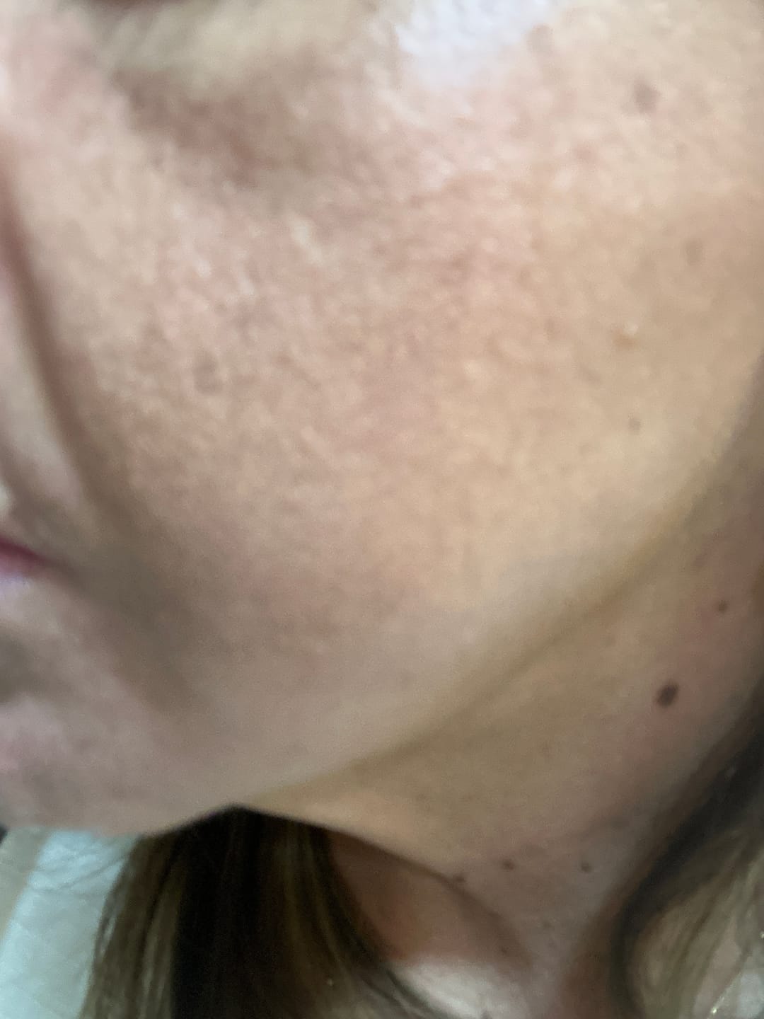 Customer photo review of Sérum Facial GHK-Cu com Peptídeos de Cobre