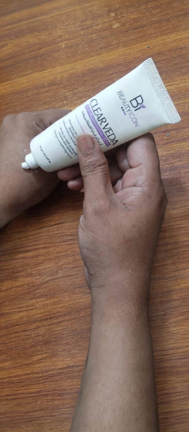 Customer photo review of Clear Veda Anti Pigmentation Cream