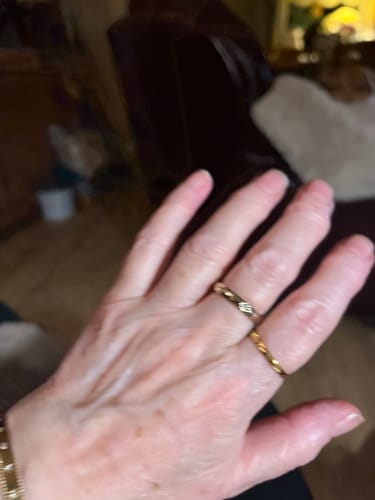 Customer photo review of Harvest & Hive™ Organic Tallow Balm - Made in the UK 🇬🇧