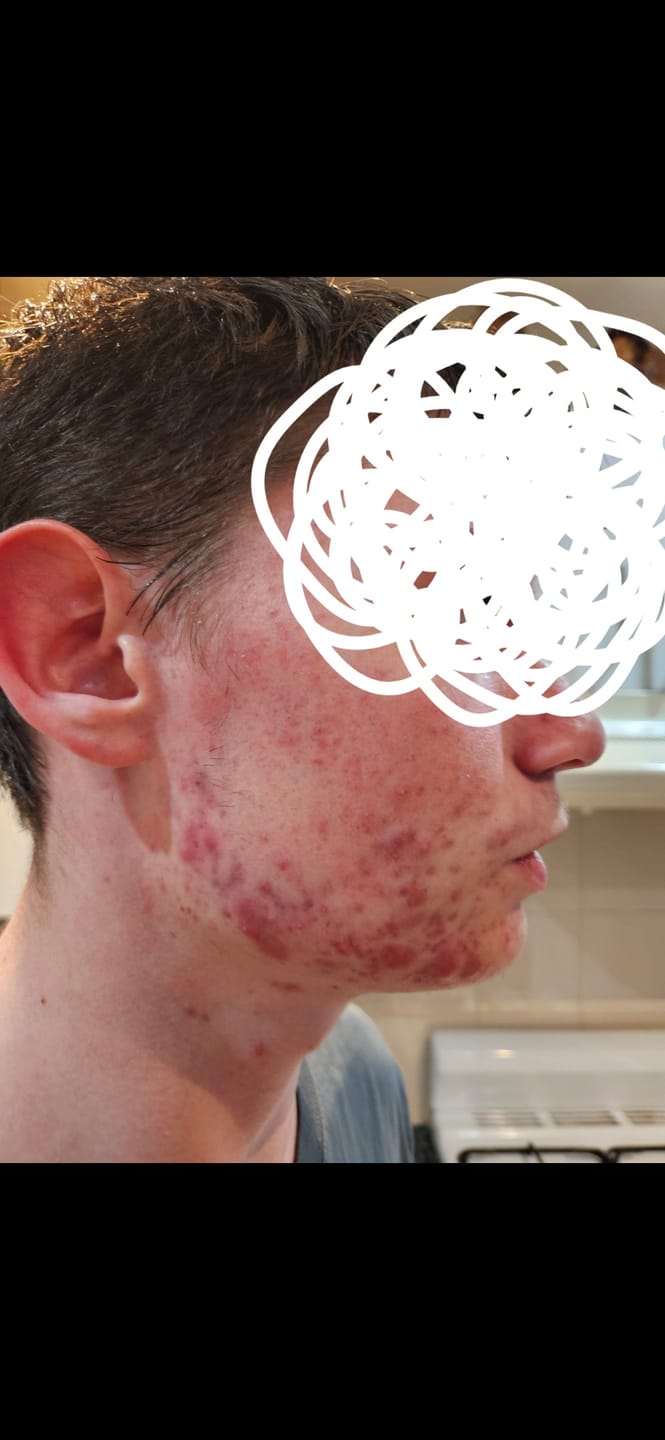 Customer photo review of Daily Facial Cleanser