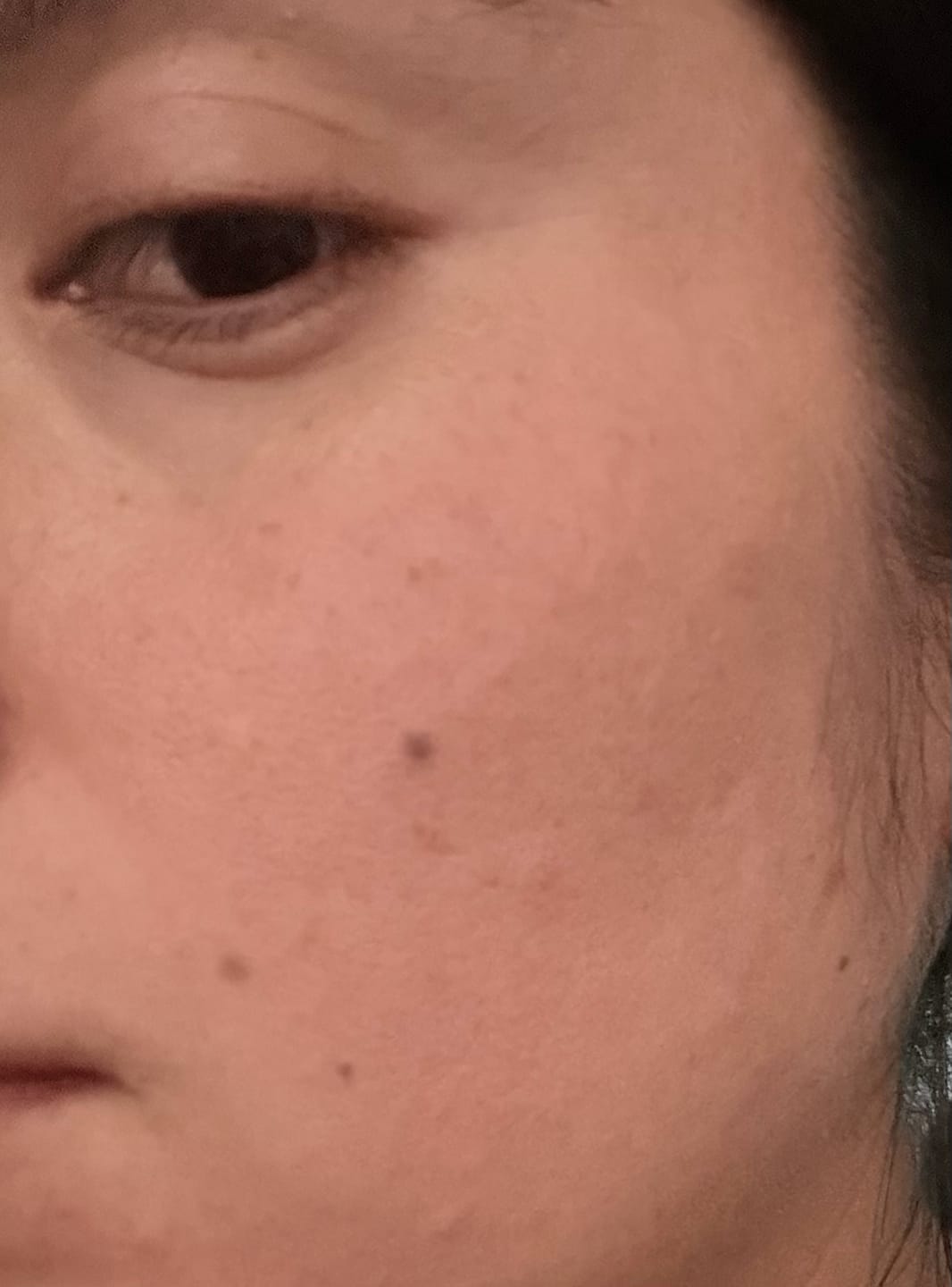 Customer photo review of La Roche Posay Anthelios UVmune400 SPF 50+ Oil Control Tinted Sunscreen - 50ml