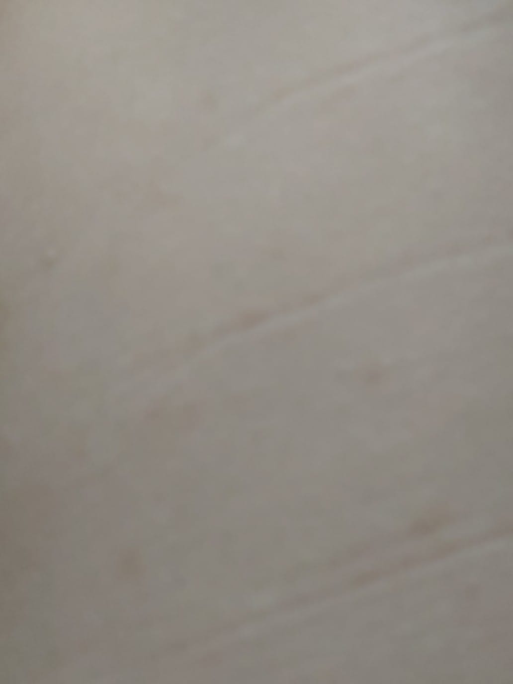 Customer photo review of Love K-Derma Body Silk IPL