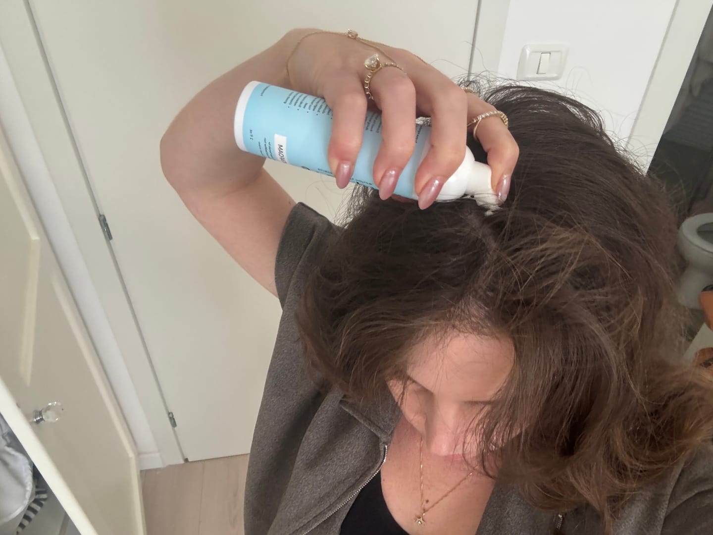 Customer photo review of VITAFOAM™ 5% Minoxidil Foam