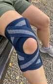 Customer photo review of Open-Knee Brace for Achy, Unsteady Knees