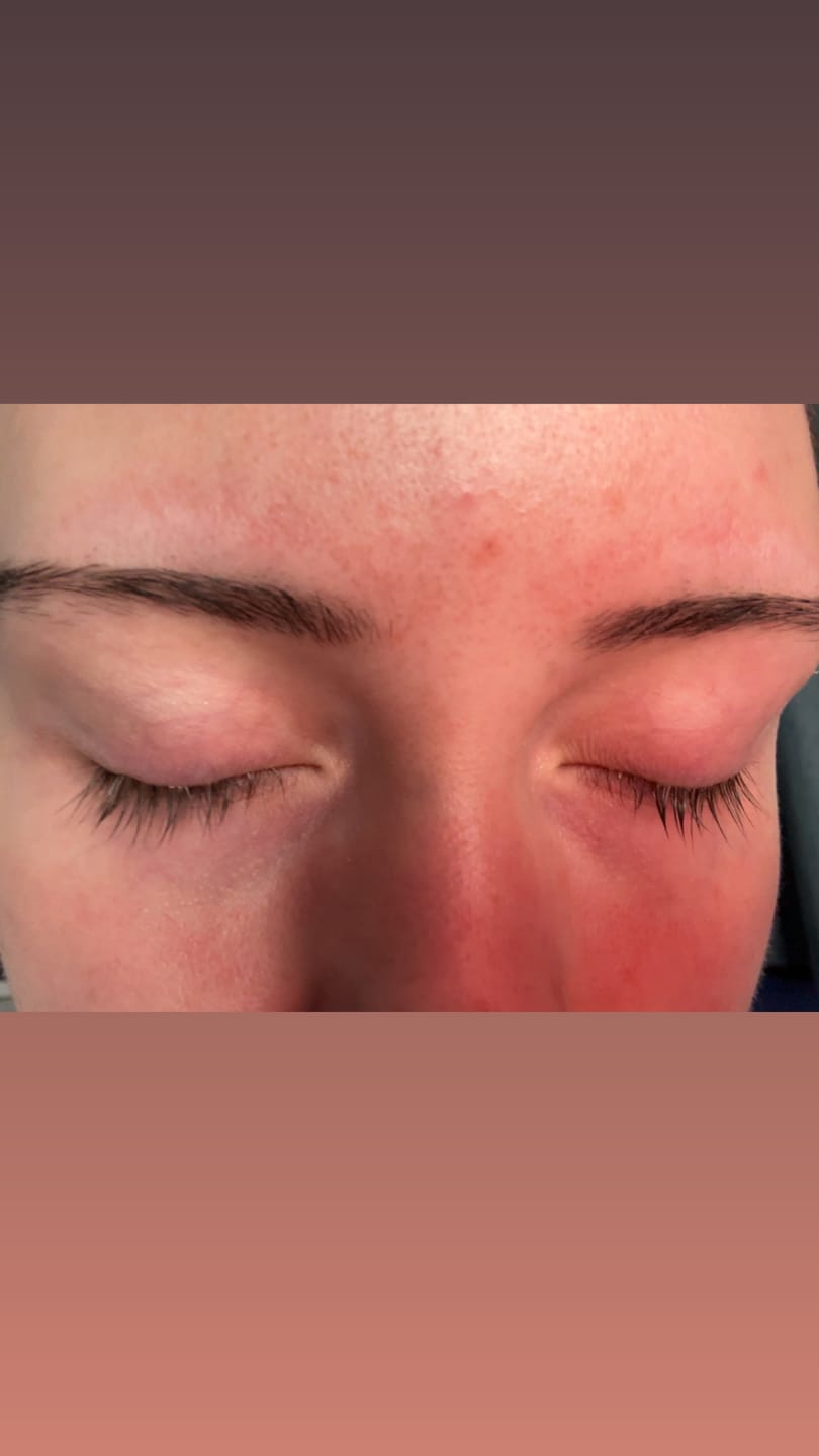 Customer photo review of Lash Serum | INTENSE