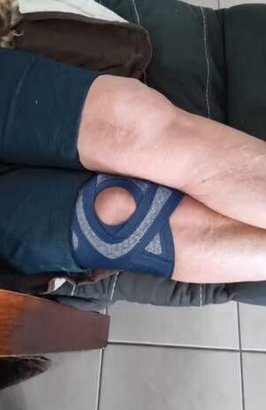 Customer photo review of Open-Knee Brace for Achy, Unsteady Knees