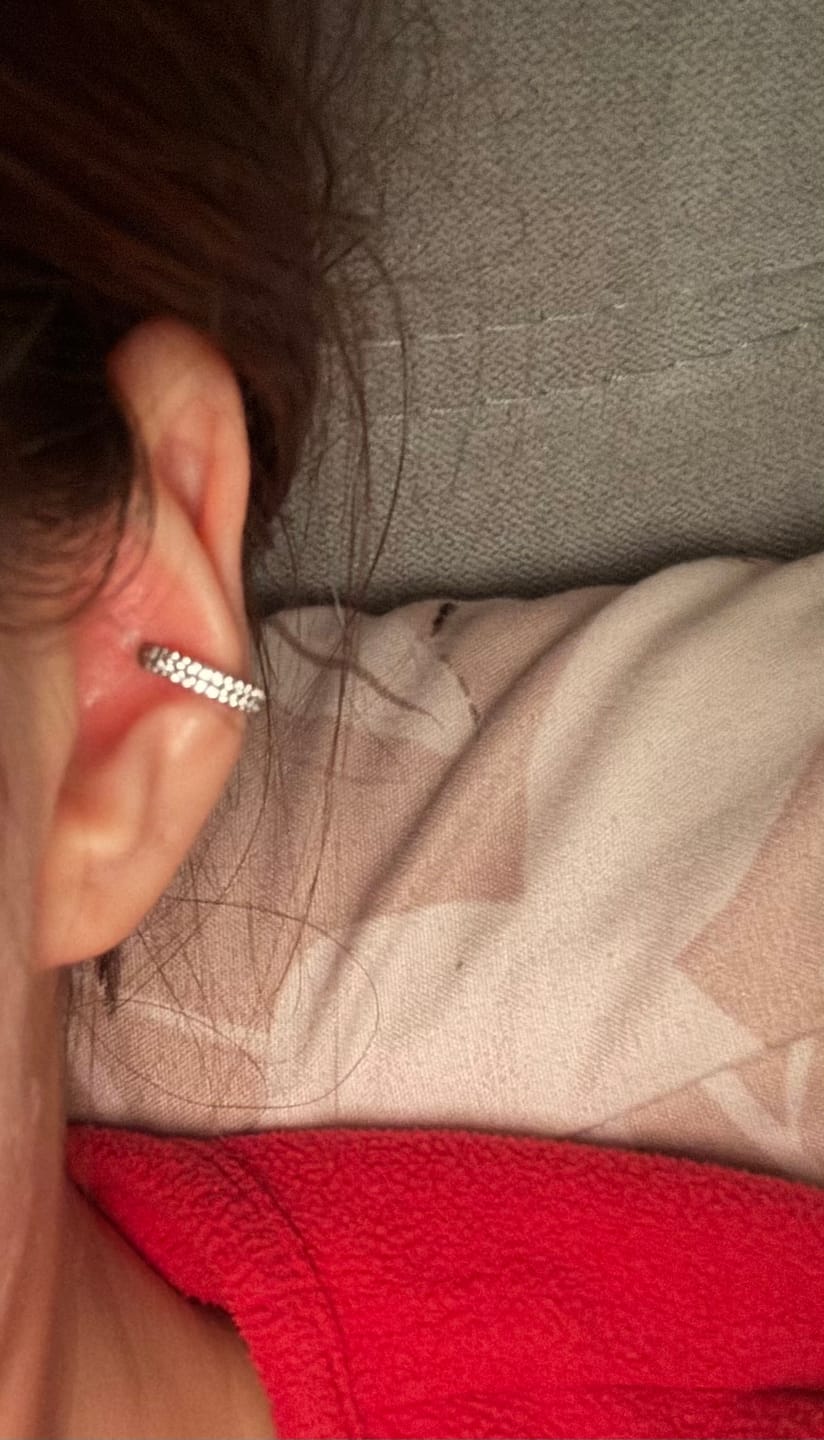Customer photo review of Double Conch Piercing | Titan